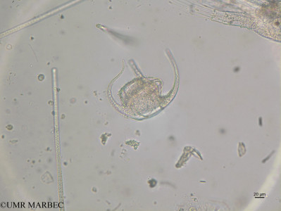 phyto/Brazilian_Nordeste/FernandodeNoronha_station40/ABRACOS2 April 2017/Tripos gibberus (st40_SUP_ceratium_gibberum_sp170906_001_ovl)(copy)_thumb.jpg